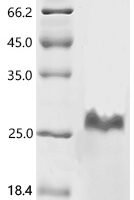 Rabbit Coagulation factor VII (F7), partial Recombinant Protein, C-His, aa 40–191, E.coli - BioCrest Sci