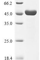 Measles virus Nucleoprotein (N), partial Recombinant Protein, N-10His/C-Myc - BioCrest Sci