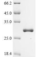 Human Metaxin-1 (MTX1), partial Recombinant Protein - BioCrest Sci