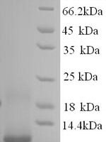 Human Metallothionein-1F (MT1F), partial Recombinant Protein - BioCrest Sci