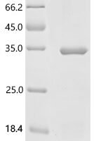 Human R3H domain-containing protein 2 (R3HDM2), partial Recombinant Protein, C-His, aa 751–976, E.coli - BioCrest Sci