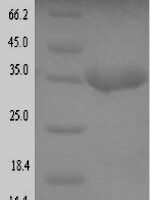 Escherichia coli O157:H7 Translocated intimin receptor Tir (tir), partial Recombinant Protein - BioCrest Sci