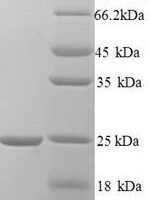 Human Hematological and neurological expressed 1 protein (HN1) Recombinant Protein, N-His - BioCrest Sci