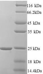 Human Hematological and neurological expressed 1 protein (HN1) Recombinant Protein, N-His, Homo sapiens (Human), Yeast, N-terminal 6xHis-tagged, 17.9 kDa, purity >≥ 90% as determined by SDS-PAGE.