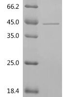 Human Prohibitin-2 (PHB2) Recombinant Protein, C-10His, aa 1–299, E.coli - BioCrest Sci