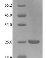 Legionella pneumophila Outer membrane protein MIP (mip),Yeast Recombinant Protein - BioCrest Sci