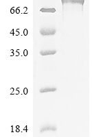 Human Band 4.1-like protein 5 (EPB41L5) Recombinant Protein, N-10His/C-Myc - BioCrest Sci