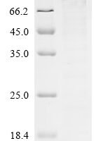 Human Segment polarity protein dishevelled homolog DVL-3(DVL3) Recombinant Protein - BioCrest Sci