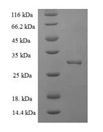Human Hematological and neurological expressed 1 protein (HN1) Recombinant Protein, N-His-SUMO - BioCrest Sci
