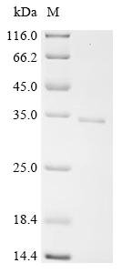 Human Regulator of G-protein signaling 16 (RGS16) Recombinant Protein, C-His, Homo sapiens (Human), E.coli, C-terminal 6xHis-tagged, 29.7 kDa, purity >≥ 90% as determined by SDS-PAGE.