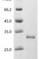 Human Ferritin heavy chain (FTH1) Recombinant Protein - BioCrest Sci