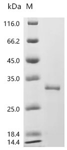 Human Ferritin heavy chain (FTH1) Recombinant Protein, Homo sapiens (Human), E.coli, C-terminal 6xHis-tagged, 28.1 kDa, purity >≥ 95% as determined by SDS-PAGE.
