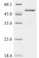 Human rhinovirus 1A Genome polyprotein, partial Recombinant Protein - BioCrest Sci