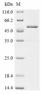 Human rhinovirus 1A Genome polyprotein, partial Recombinant Protein, Human rhinovirus 1A (HRV-1A), E.coli, N-terminal 6xHis-SUMO-tagged, 45.5 kDa, purity >≥ 85% as determined by SDS-PAGE.