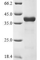 Mouse Histamine N-methyltransferase (Hnmt) Recombinant Protein - BioCrest Sci