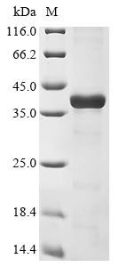Mouse Histamine N-methyltransferase (Hnmt) Recombinant Protein, Mus musculus (Mouse), E.coli, N-terminal 10xHis-tagged and C-terminal Myc-tagged, 41.1 kDa, purity >≥ 85% as determined by SDS-PAGE.