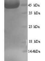 Human Myosin-binding protein C, fast-type (MYBPC2), partial Recombinant Protein, N-His, aa 739–1141, Yeast - BioCrest Sci