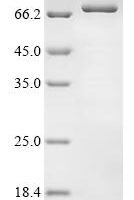Human Interferon kappa (IFNK) Recombinant Protein - BioCrest Sci