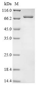 Human Interferon kappa (IFNK) Recombinant Protein, Homo sapiens (Human), Yeast, C-terminal 6xHis-PDI-tagged, 80.1 kDa, purity >≥ 90% as determined by SDS-PAGE.