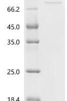 Human Gamma-taxilin (TXLNG) Recombinant Protein - BioCrest Sci