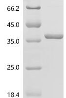 Human Glyceraldehyde-3-phosphate dehydrogenase (GAPDH) Recombinant Protein, N-His - BioCrest Sci