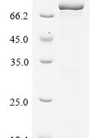 Mouse Desmoglein-3 (Dsg3), partial Recombinant Protein, N-SUMOstar/C-His - BioCrest Sci