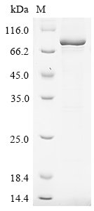 Mouse Desmoglein-3 (Dsg3), partial Recombinant Protein, N-SUMOstar/C-His, Mus musculus (Mouse), Baculovirus, N-terminal sumostar-tagged and C-terminal 6xHis-tagged, 75.4 kDa, purity >≥ 85% as determined by SDS-PAGE.