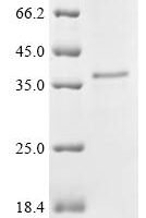 Mouse Adipolin (C1qtnf12) Recombinant Protein - BioCrest Sci