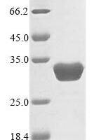 Human Sepiapterin reductase (SPR) Recombinant Protein - BioCrest Sci