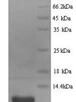 Human C-X-C motif chemokine 10 (CXCL10) Recombinant Protein, N-His - BioCrest Sci