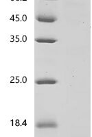 Mouse Platelet-derived growth factor subunit A (Pdgfa) Recombinant Protein, C-10His-HSA - BioCrest Sci