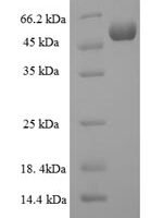 Human Protein-tyrosine sulfotransferase 2 (TPST2), partial Recombinant Protein - BioCrest Sci