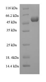 Human Protein-tyrosine sulfotransferase 2 (TPST2), partial Recombinant Protein, Homo sapiens (Human), E.coli, N-terminal 6xHis-SUMO-tagged, 55.3 kDa, purity >≥ 90% as determined by SDS-PAGE.