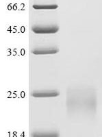 Mouse Sorcin (Sri) Recombinant Protein, N-His, aa 1–198, Mammalian cell - BioCrest Sci