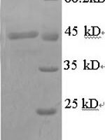 Pig Transcobalamin-1 (TCN1) Recombinant Protein - BioCrest Sci