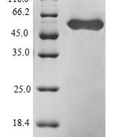 Human Zinc finger protein 91 (ZNF91), partial Recombinant Protein - BioCrest Sci