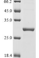 Klebsiella oxytoca Carbapenem-hydrolyzing beta-lactamase KPC (bla) Recombinant Protein, Tag-Free - BioCrest Sci