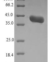 Candida albicans Agglutinin-like protein 3 (ALS3), partial Recombinant Protein, N-10His-B2M/C-Myc - BioCrest Sci
