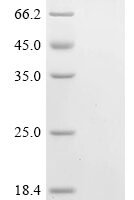 Aquifex aeolicus DNA mismatch repair protein MutS (mutS),Biotinylated Recombinant Protein - BioCrest Sci