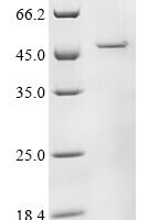 Rotavirus A Intermediate capsid protein VP6 Recombinant Protein, C-His - BioCrest Sci