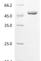 Human F-box only protein 22 (FBXO22) Recombinant Protein - BioCrest Sci