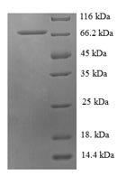 Human Histidine--tRNA ligase, mitochondrial (HARS2) Recombinant Protein - BioCrest Sci