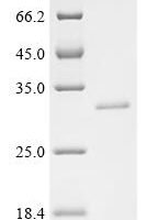 Shigella sonnei Flagellar L-ring protein (flgH) Recombinant Protein - BioCrest Sci