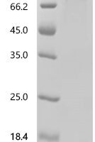 Mouse Alanine--tRNA ligase, cytoplasmic (Aars1) Recombinant Protein, C-His, aa 1–968, Mammalian cell - BioCrest Sci
