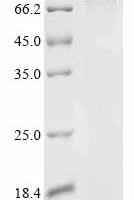 Human Cullin-3 (CUL3) Recombinant Protein - BioCrest Sci
