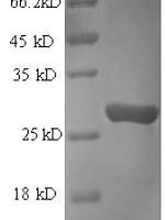 Human Protein transport protein Sec16A (SEC16A), partial Recombinant Protein - BioCrest Sci