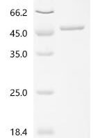Human V-type proton ATPase subunit d 1 (ATP6V0D1) Recombinant Protein - BioCrest Sci