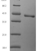 Human N-glycosylase/DNA lyase (OGG1) Recombinant Protein, N-His, aa 1–345, E.coli - BioCrest Sci