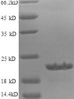 Human Diamine acetyltransferase 1 (SAT1) Recombinant Protein, N-His - BioCrest Sci