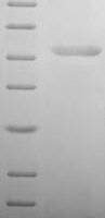 Human Regulator of G-protein signaling 5 (RGS5) Recombinant Protein - BioCrest Sci